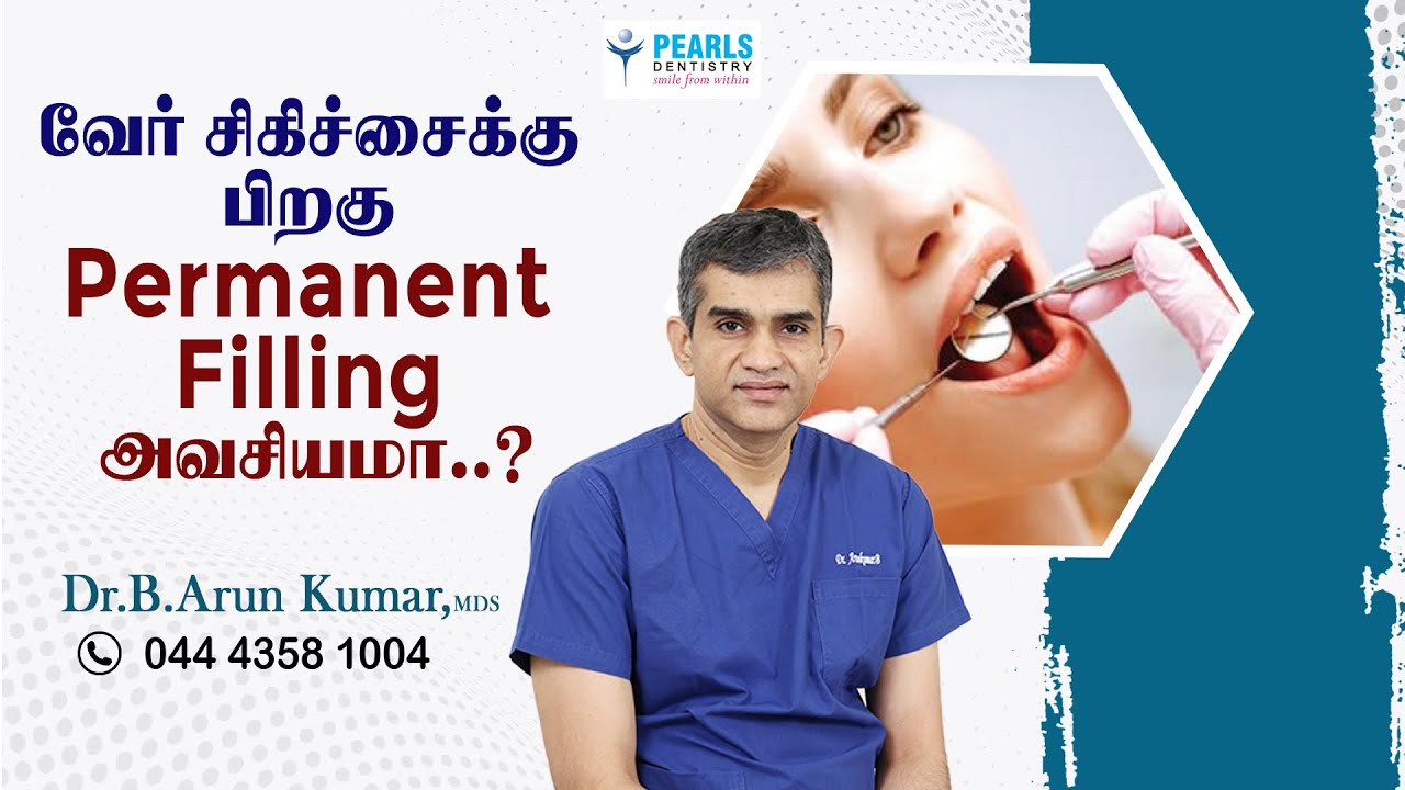 Is a permanent filling necessary after a dental root canal treatment..?-Pearl Dentistry-Dr.Arunkumar