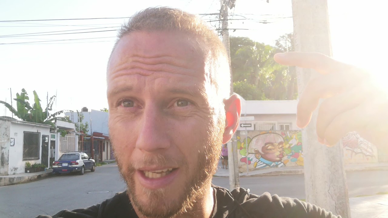 GREFFE DE CHEVEUX EN TURQUIE (5 mois)