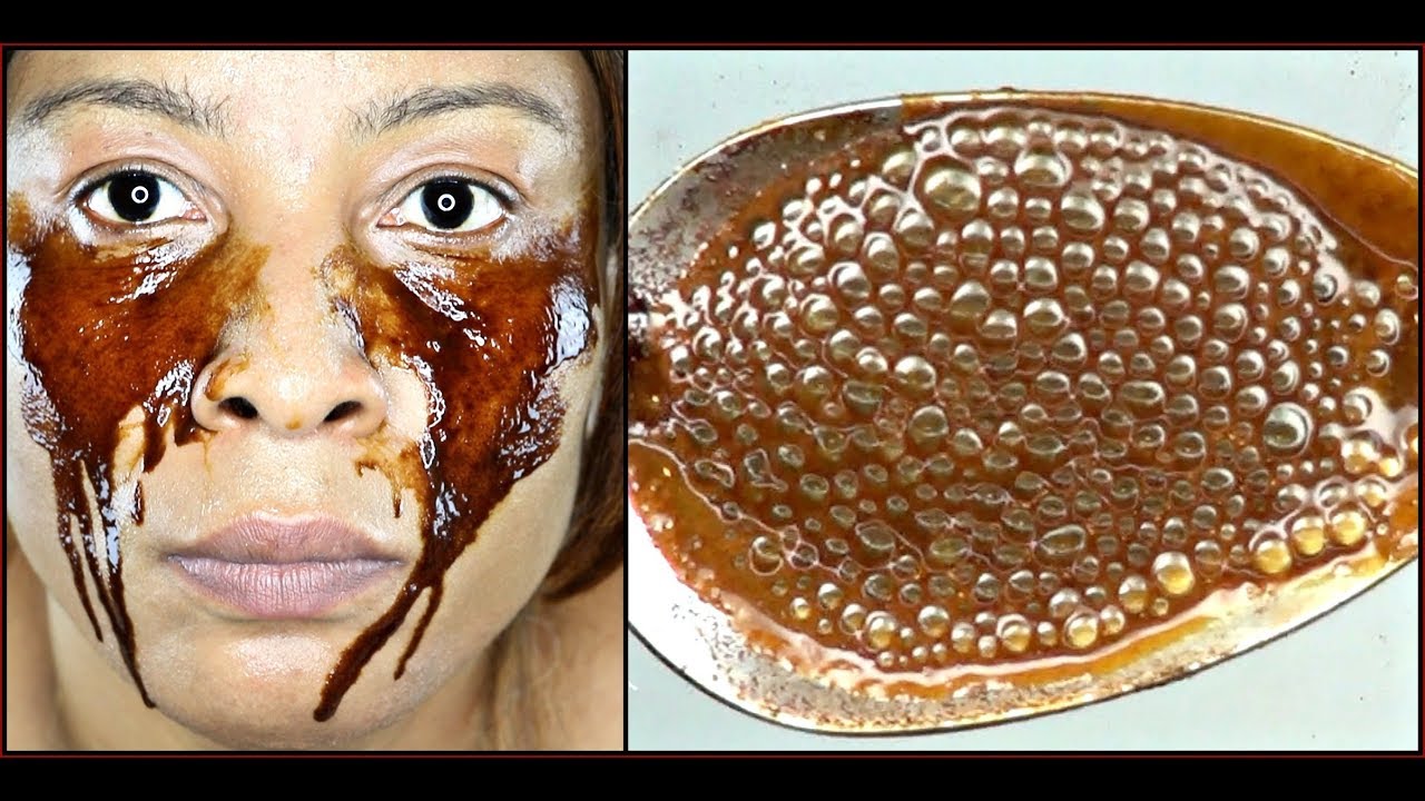 REMOVE DARK CIRCLES, EYES BAGS, PUFFY EYES + WRINKLES, 100% EFFECTIVE |Khichi Beauty