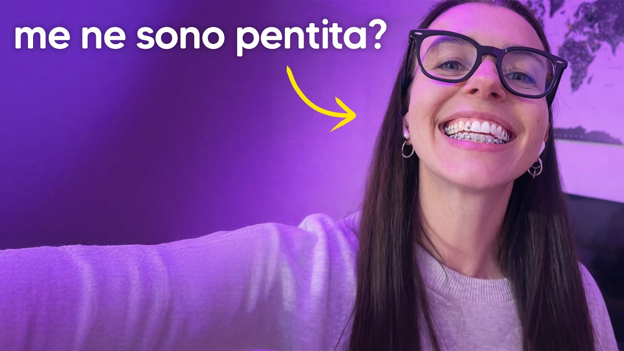 Ho Messo l'Apparecchio a 40 Anni #4