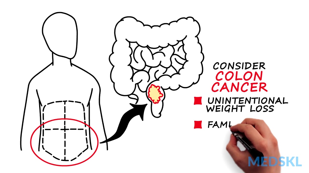 Abdominal and Pelvic Masses: What location can tell you about a mass