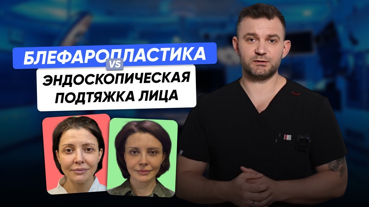 Блефаропластика или эндоскопическая подтяжка лица?
