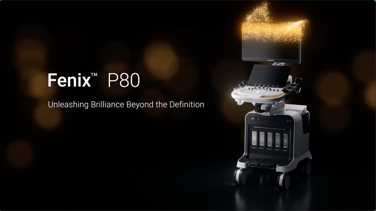 Fenix 80 Series: Unleashing Brilliance Beyond the Definition