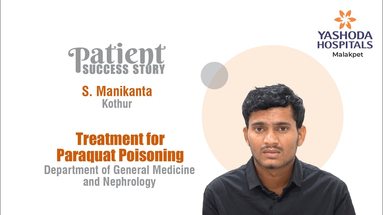 Treatment for Paraquat Poisoning | Charcoal Hemoperfusion | Yashoda Hospitals Hyderabad