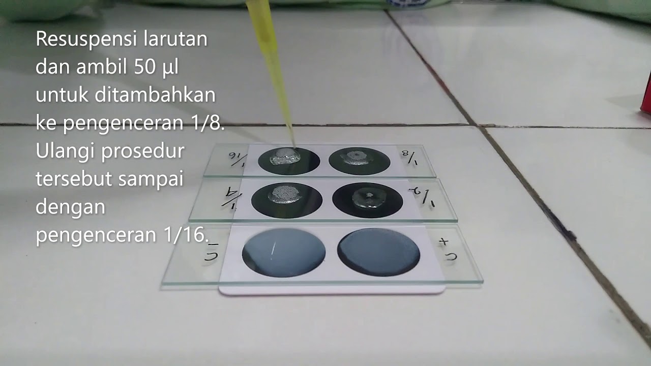 Pemeriksaan Rheumatoid Factor (RF) semi-kuantitatif