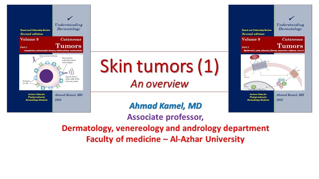 Skin Tumors 1