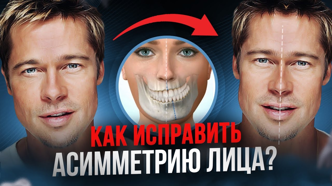Асимметрия лица. Причины возникновения и нужно ли ее исправлять?