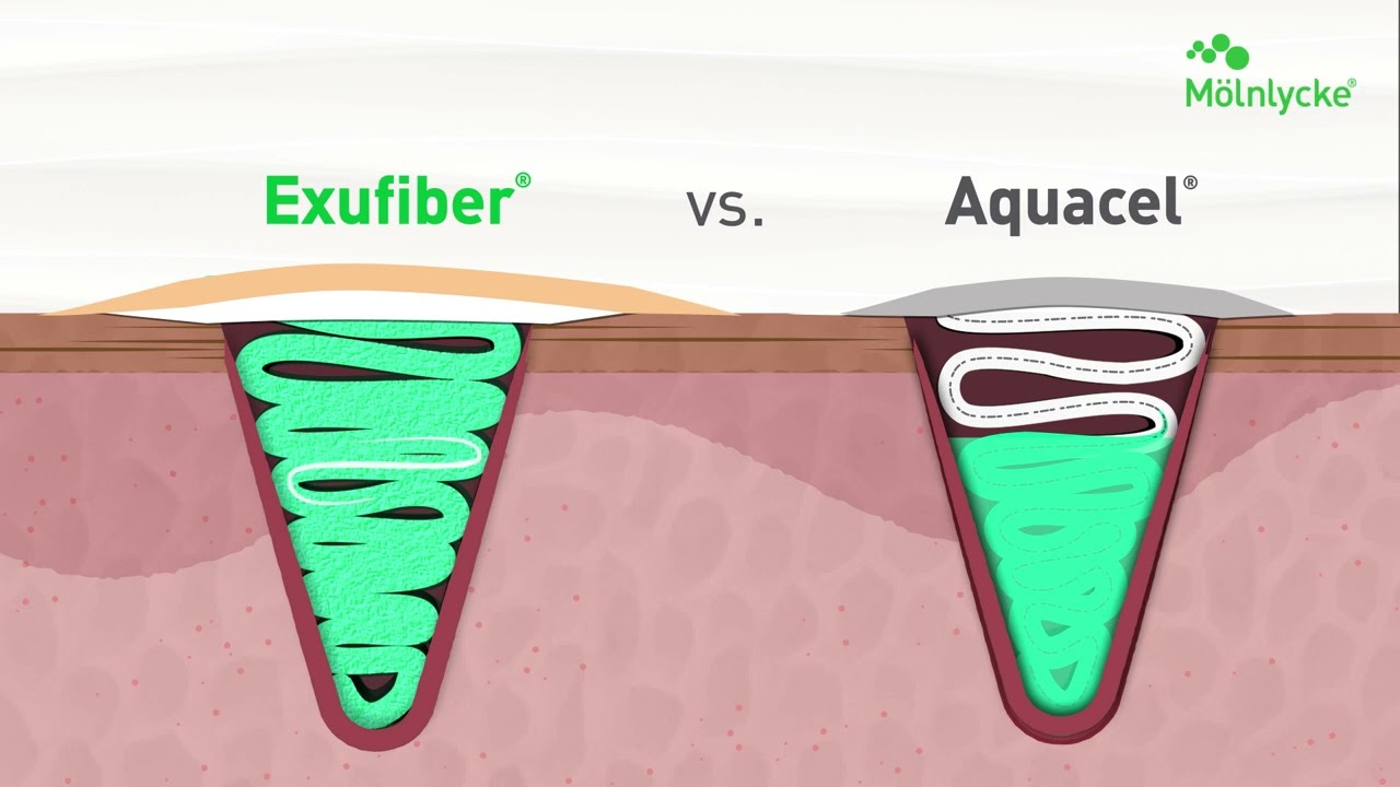 See Exufiber In Action