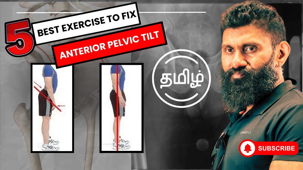 Anterior pelvic tilt  | 5 exercises to fix | postural correction  | Biglee Tamil