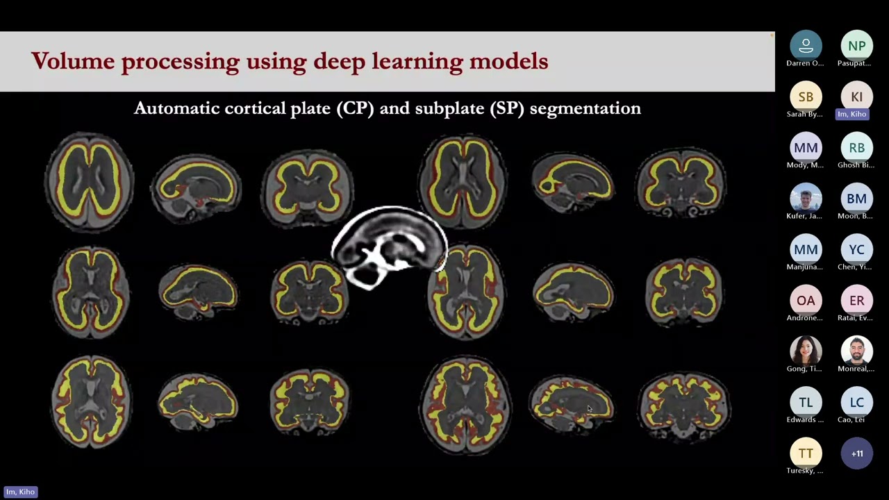 BrainMap: From Fetal MRI to Future Outcomes: Multimethod Insights into Early Human Brain Development