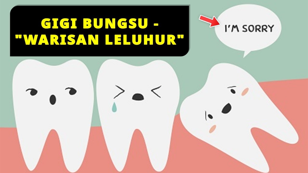 Gigi Bungsu: 