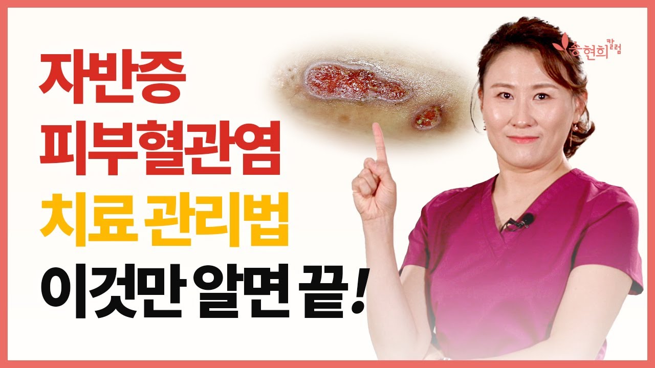 자반증, 혈관염 낫고 싶다면  꼭! 따라하세요  ft. 연고, 상처관리, 운동, 목욕