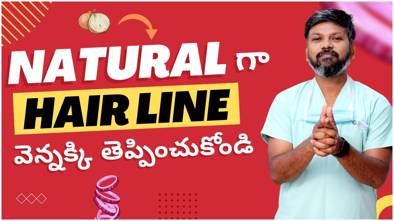 #AskDrJohnWatts | NATURAL గా HAIR LINE వెన్నక్కి తెప్పించుకోండి | Hair Specialist Explains