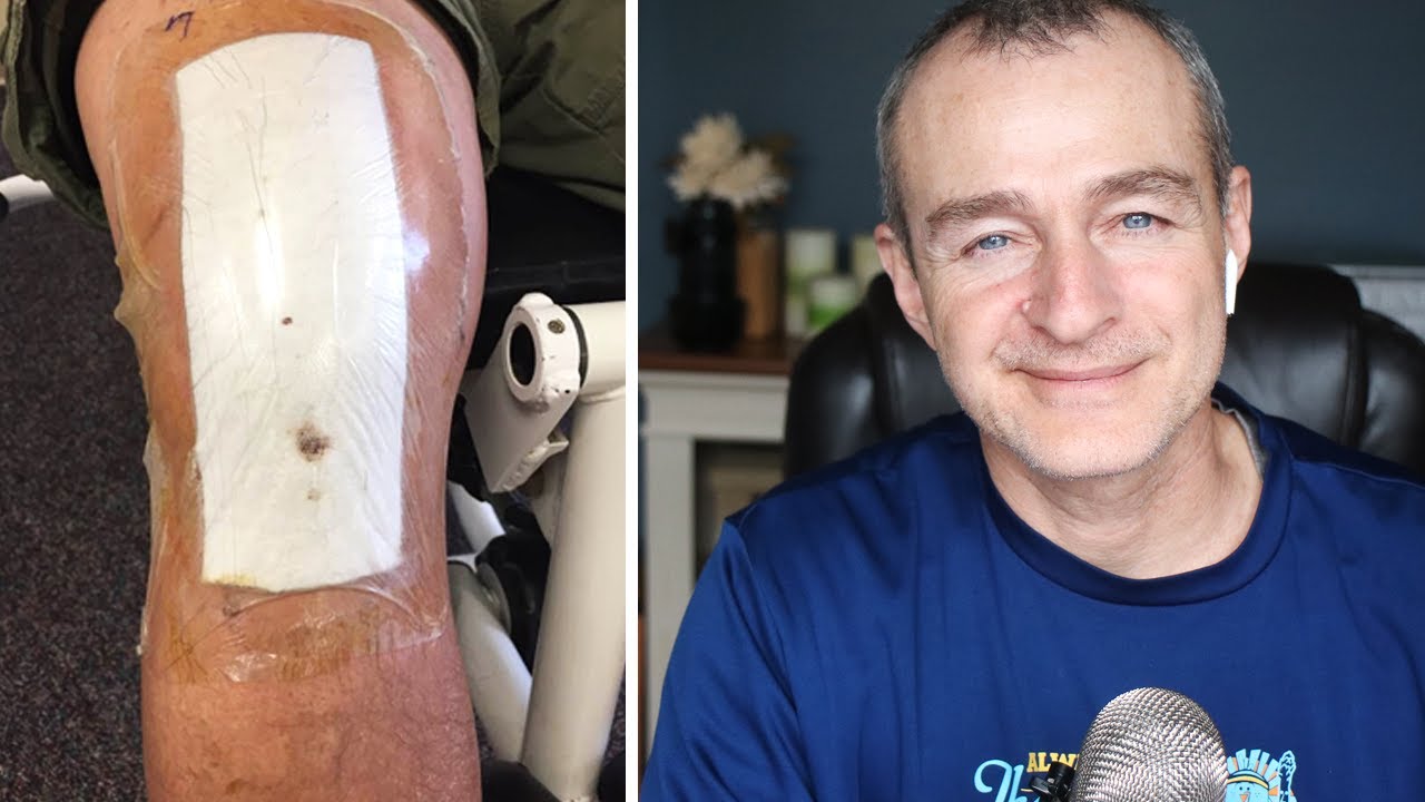 How do I know when I need a total knee replacement?
