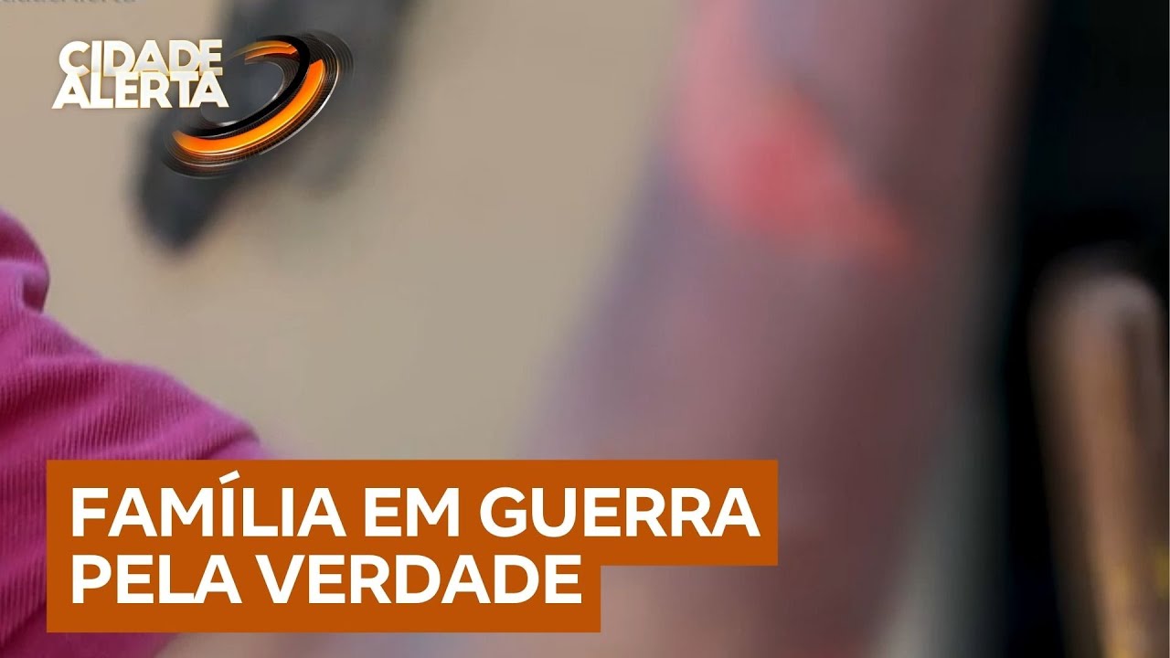 Mulher fica gravemente ferida após ter a casa incendiada; troca de acusações aumenta tensão