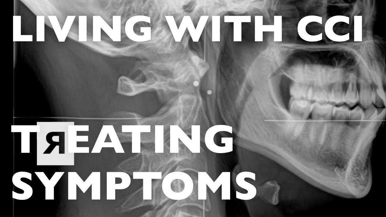 (4) Treating Symptoms of Craniocervical Instability