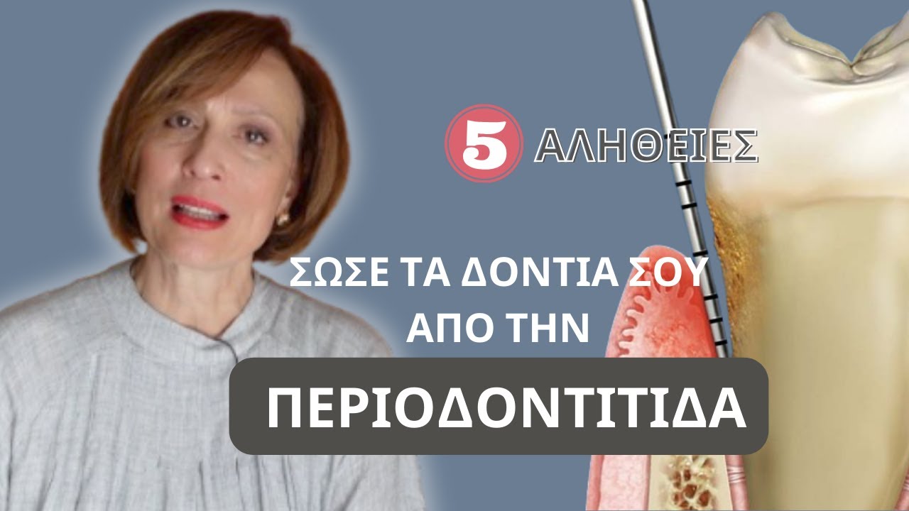5 ΑΛΗΘΕΙΕΣ για την ΠΕΡΙΟΔΟΝΤΙΤΙΔΑ, που πρέπει να γνωρίζεις