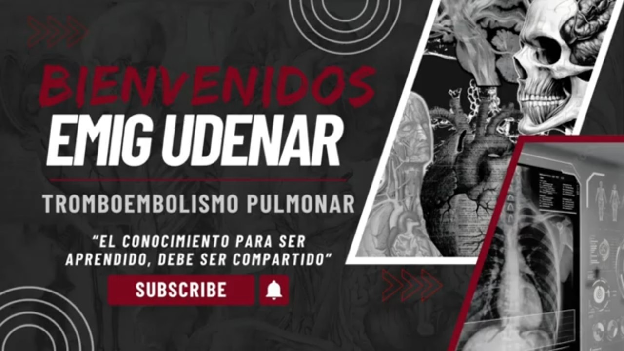 TROMBOEMBOLISMO PULMONAR BY DR ERWIN GUERRERO