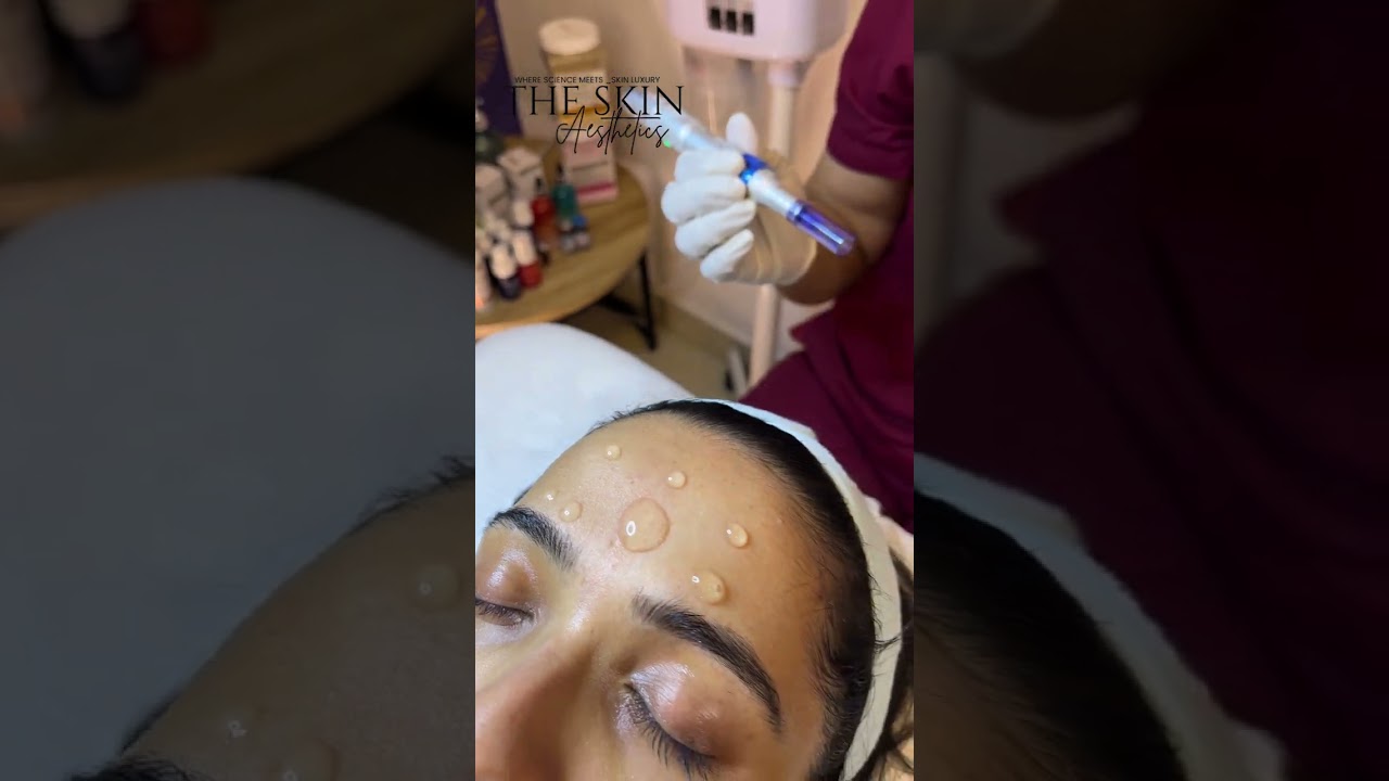 Skin Booster Treatment in Ludhiana | Instant Glow & Glass Skin at The Skin Aesthetics #beauty