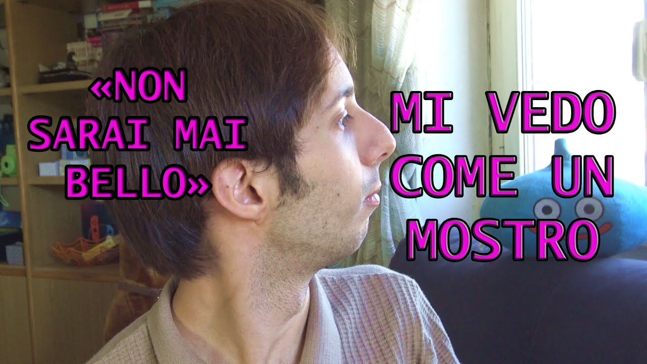 Mi sento BRUTTO (Naso storto, mento sfuggente)