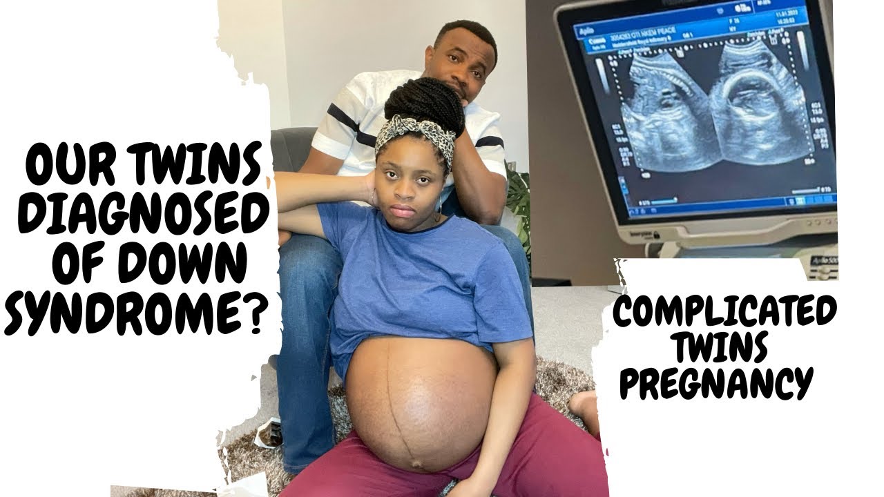 OUR TWINS DIAGNOSED OF DOWN SYNDROME?? COMPLICATED TWINS PREGNANCY | POLYHYDRAMNIOUS ISSUES