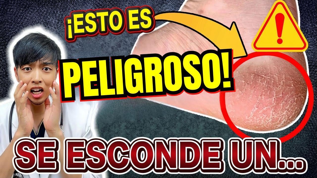 ¡Cuidado! No te limes los talones resecos: señales de alerta en tus pies que no debes ignorar