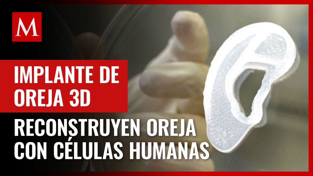 Científicos reconstruyen una oreja gracias a tejido de células humanas impreso en 3D