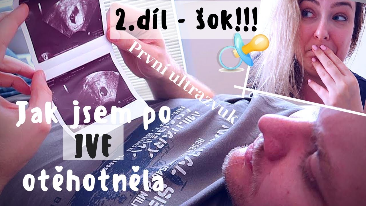 Jak jsem po IVF otěhotněla 2.díl | 1. ultrazvuk | Šokující zprávy | Jak mi je | #5TěhuDeníček