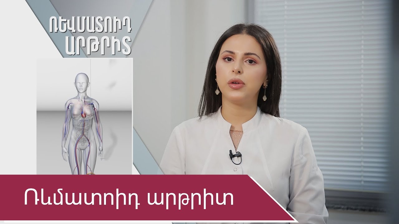 Ռևմատոիդ արթրիտ