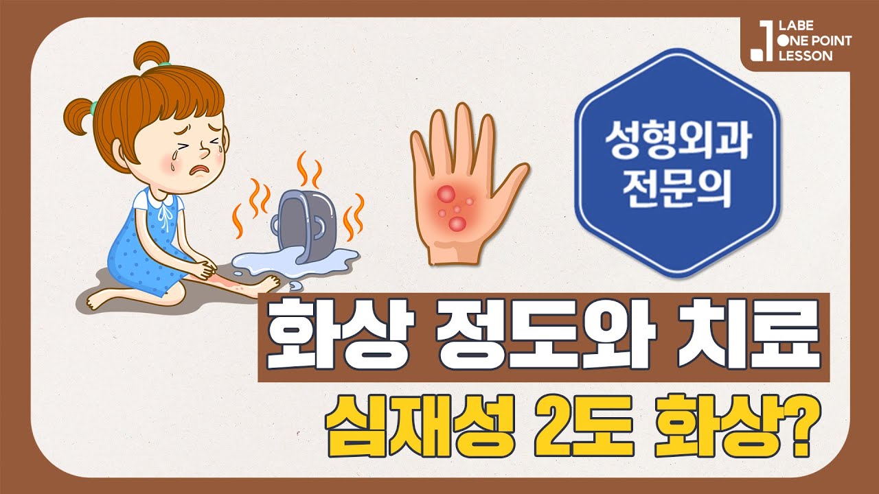 심재성 2도화상? 화상의 깊이에 따른 종류와 초기처치의 중요성! [성형외과 전문의]