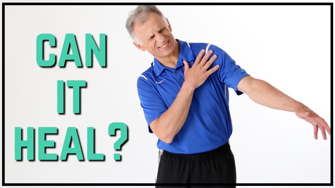 Can I Heal My Torn Rotator Cuff, Science Shows Positive Results Without Surgery, MUST See!