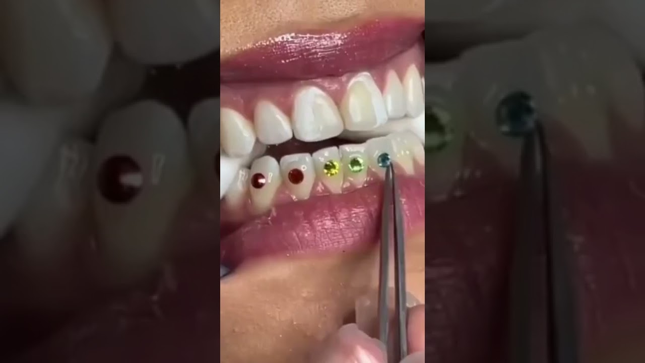 Dental piercing🥰😉 subscribe for channel &hearts;️