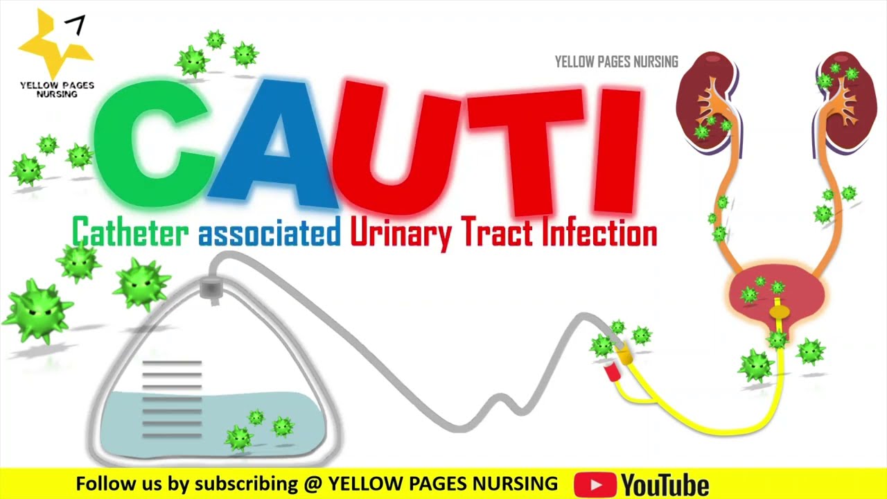 Catheter associated Urinary Tract Infection | CAUTI Care Bundle | CAUTI BUNDLE