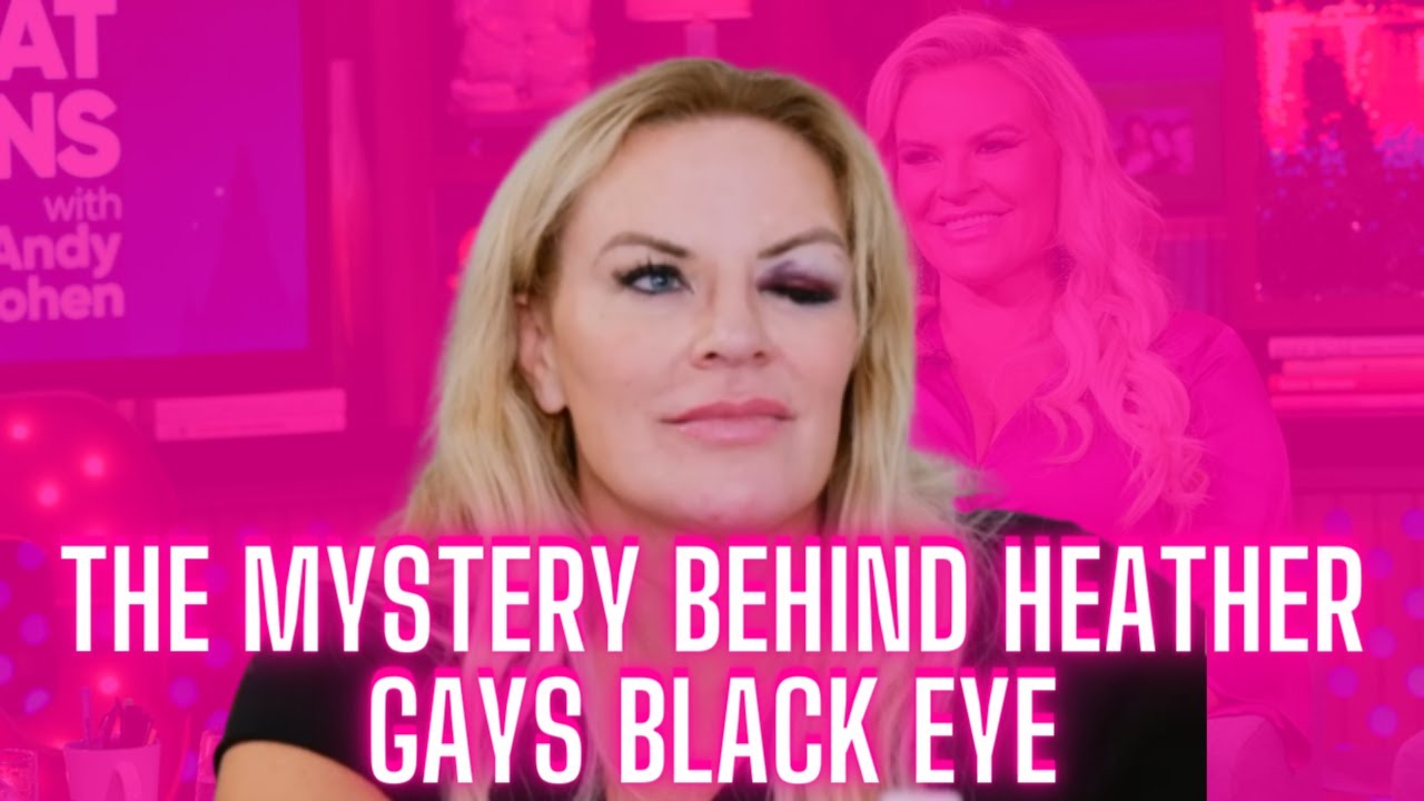 The Mystery around Heather Gays Black Eye! 