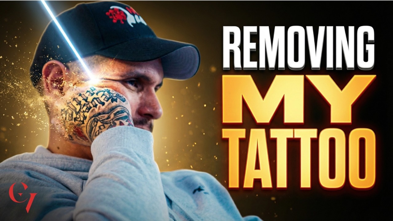 Удаление моей татуировки