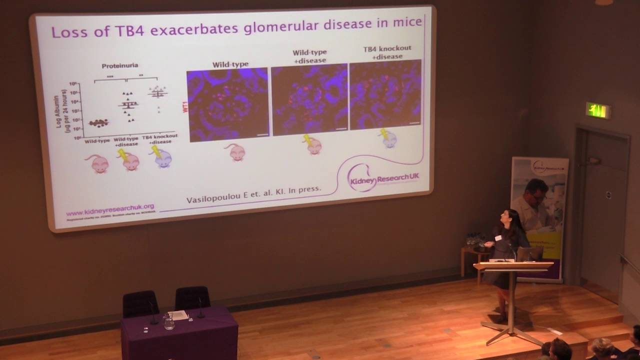 Investigating the role of thymosim-B4 in maintaining podocyte shape and function