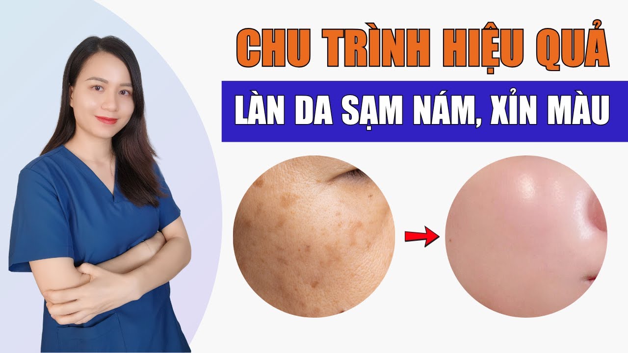 Da bị nám, xỉn màu… skincare thế nào cho đúng?” | Nguyễn Mai Hương
