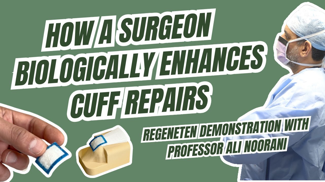 What Is Regeneten and Surgical Technique Demonstration with Professor Ali Noorani | Rotator Cuff