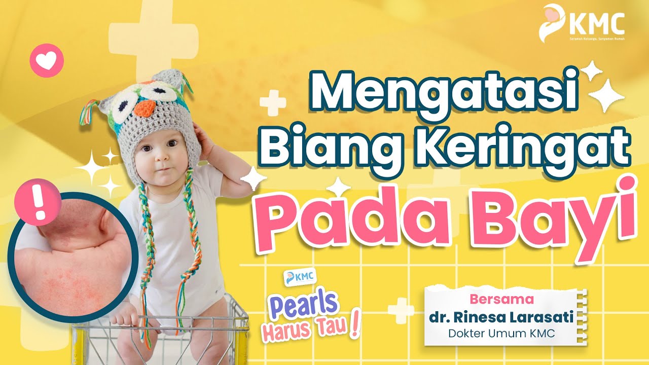 CARA MENGATASI BIANG KERINGAT PADA BAYI