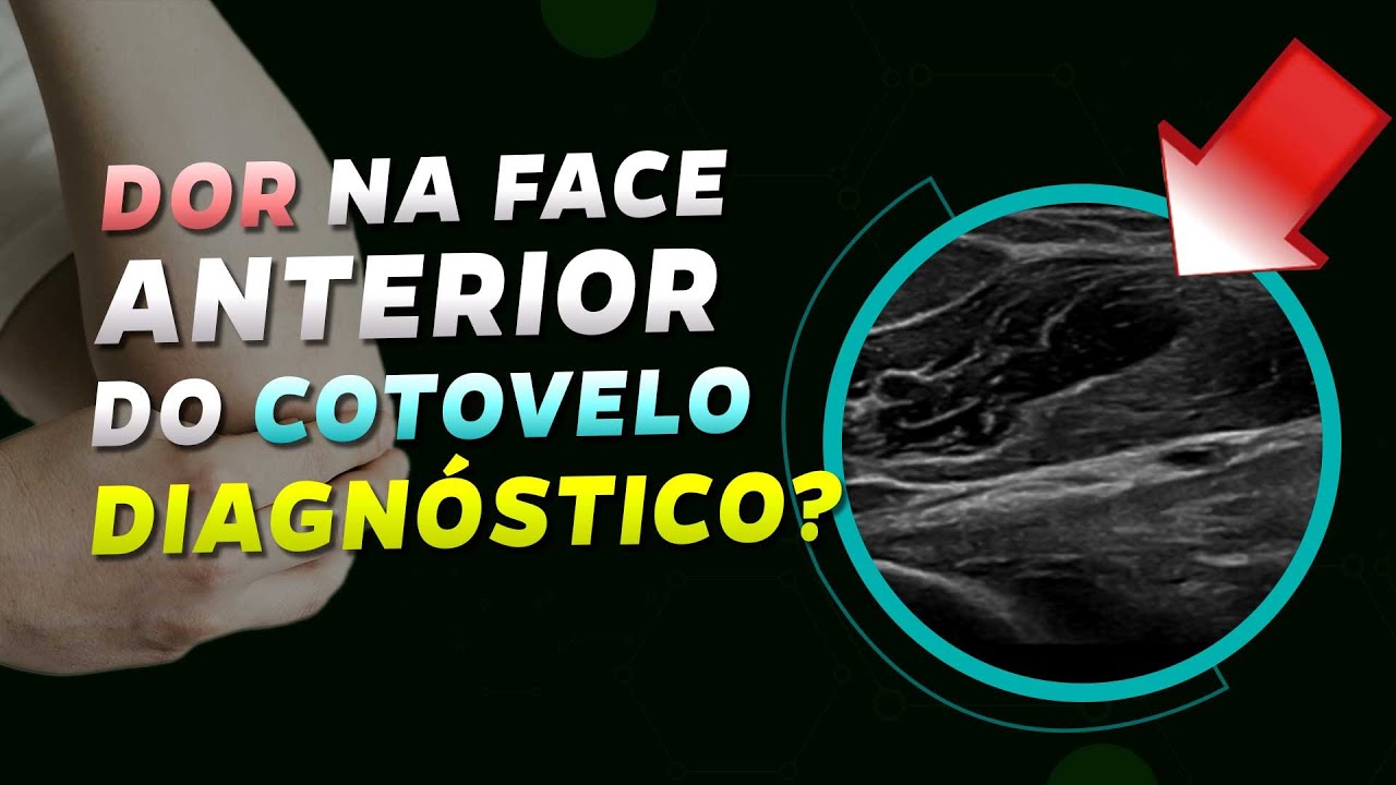 Ultrassom do cotovelo: o que é? | Caso 033 - MSKD