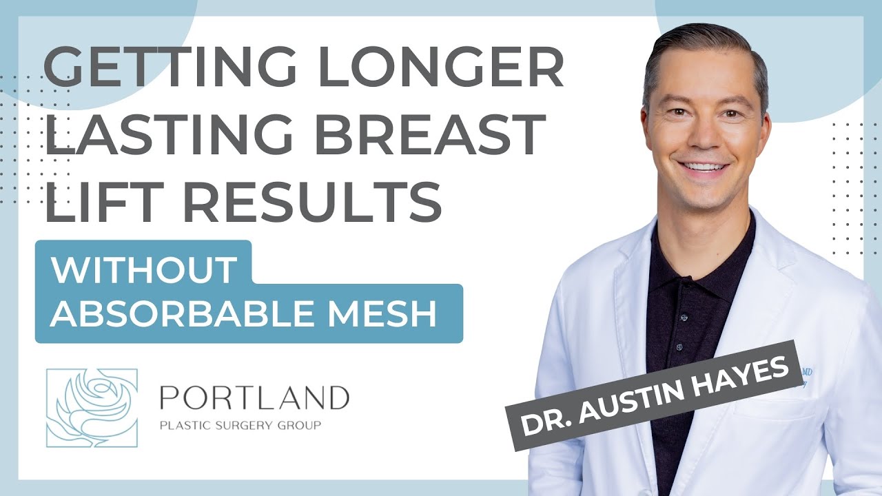 Getting longer lasting internal bra breast lift results without absorbable mesh #NoBraNoProblem