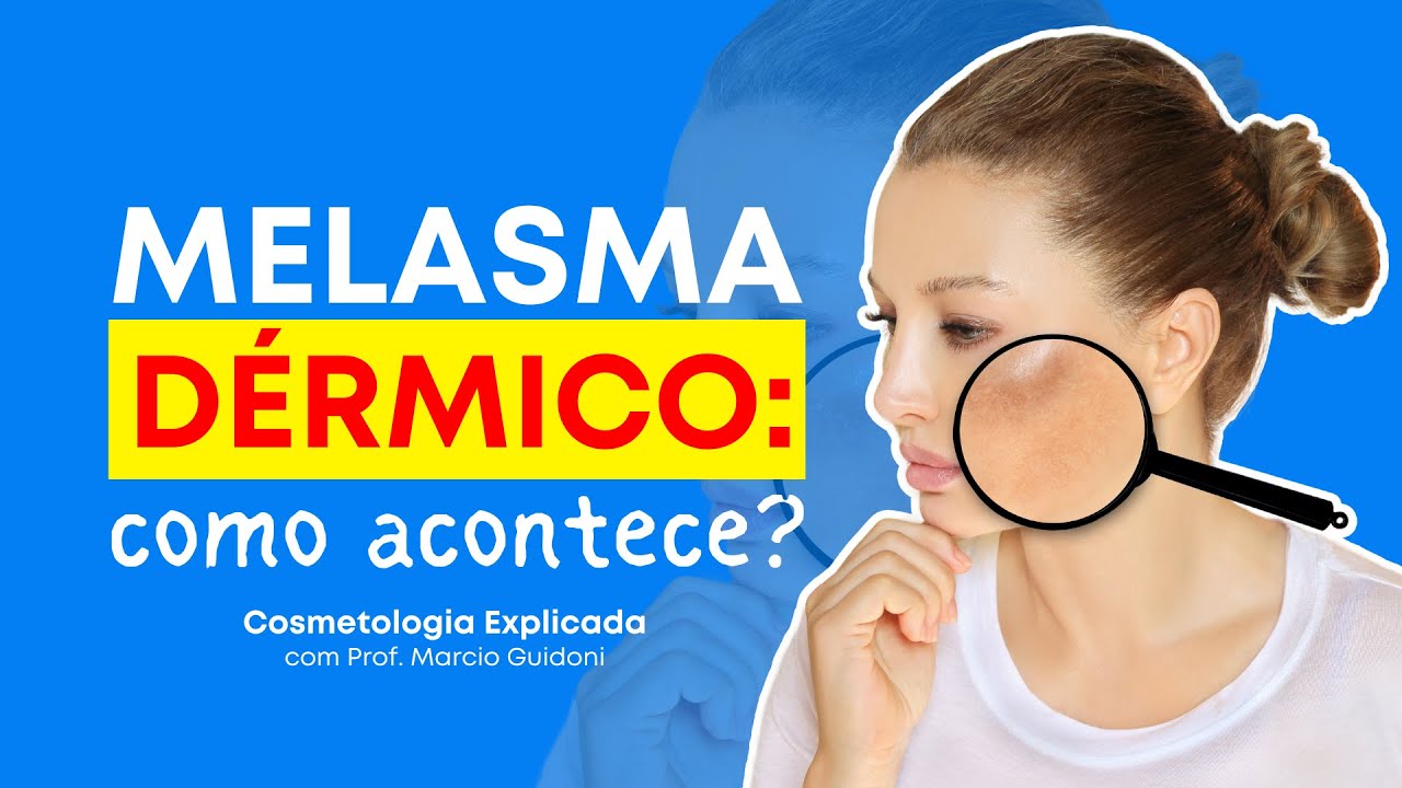 COMO O MELASMA DÉRMICO ACONTECE? | Cosmetologia Explicada com Prof. Marcio Guidoni