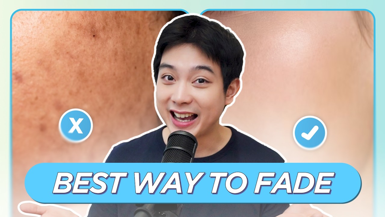 DARK SPOTS EXPLAINED: The REAL Way Para Mawala Ito (Derma APPROVED)