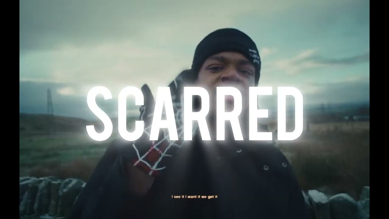 [FREE] Kidwild X Nemzzz Type Beat 2025 - “SCARRED”