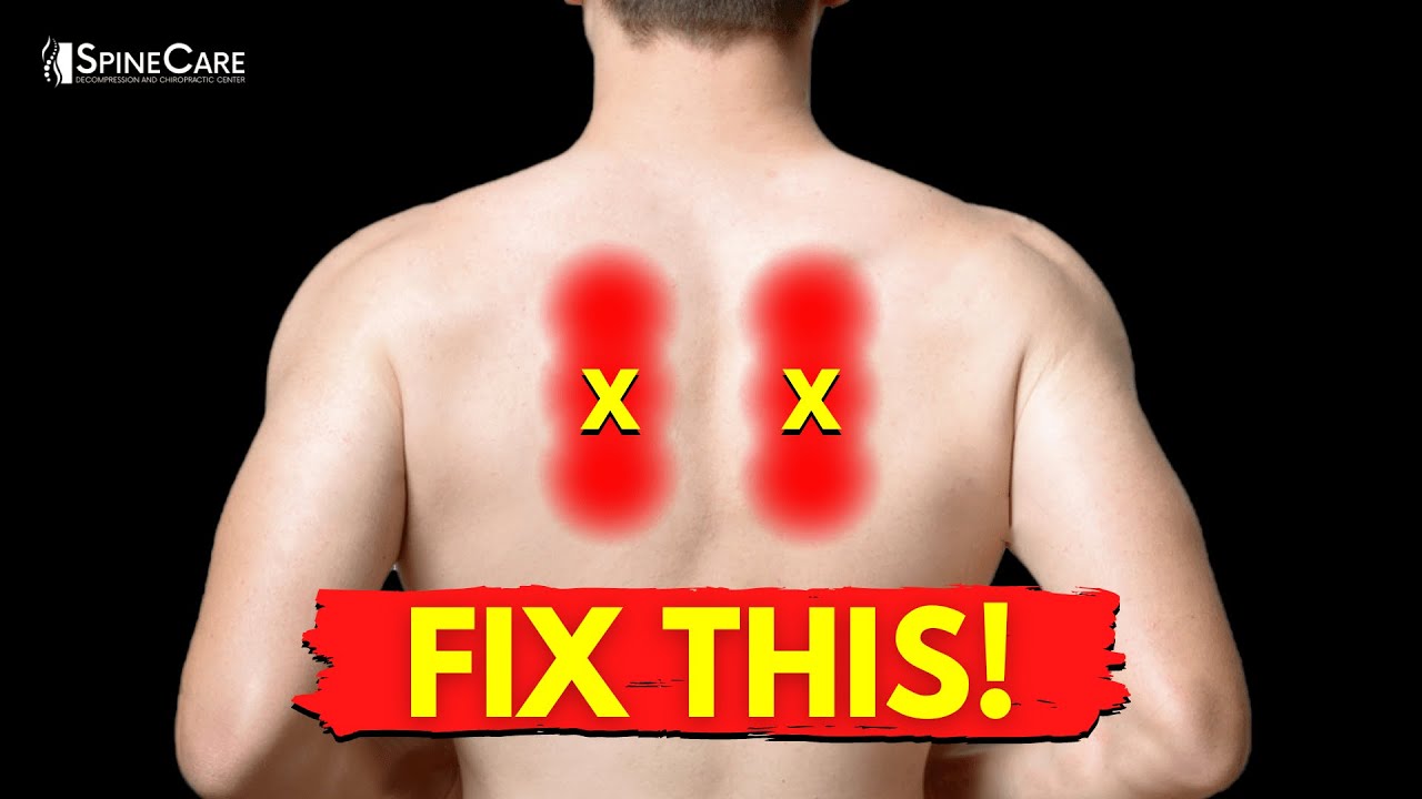 How to Fix SHARP Pain Between the Shoulder Blades