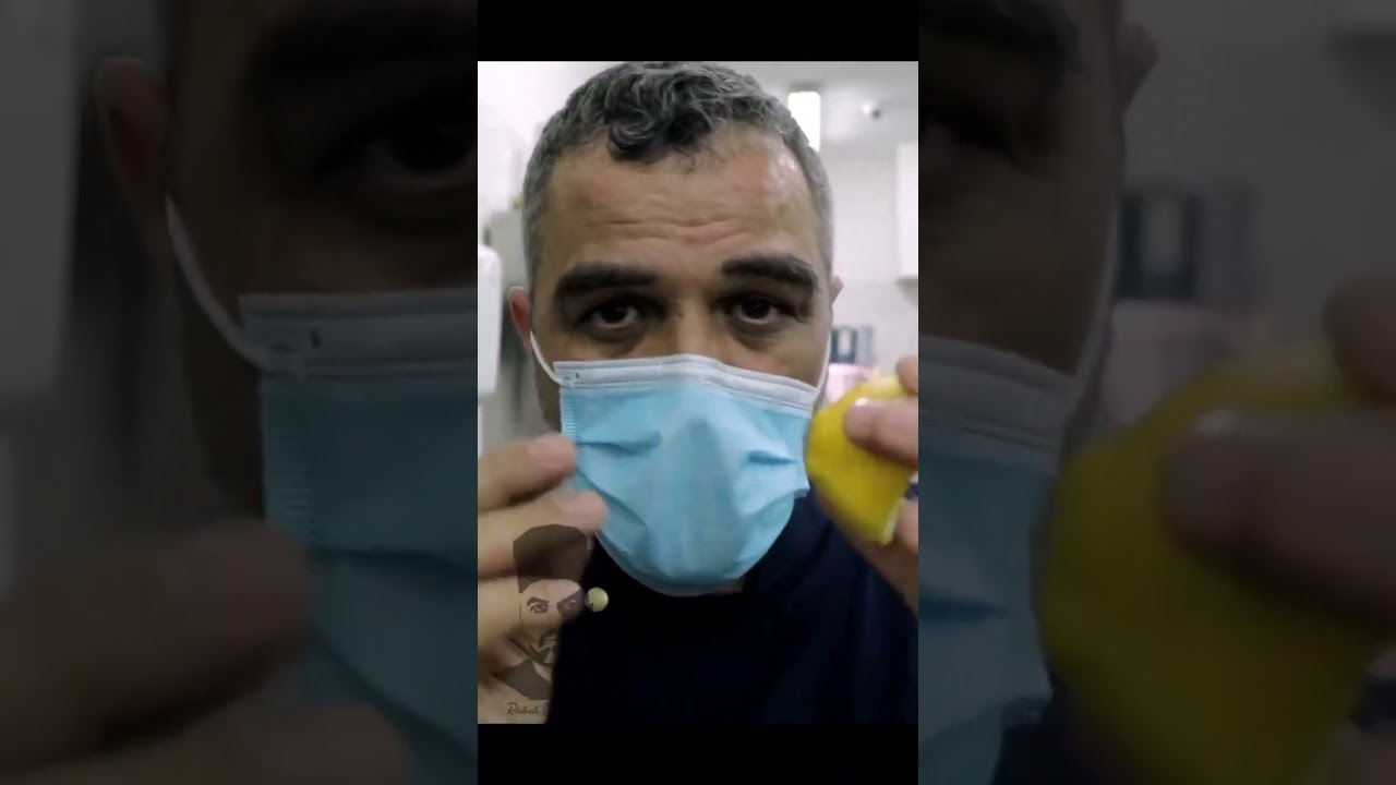 ✔قشور تاع القارص ❌ كنز كبير