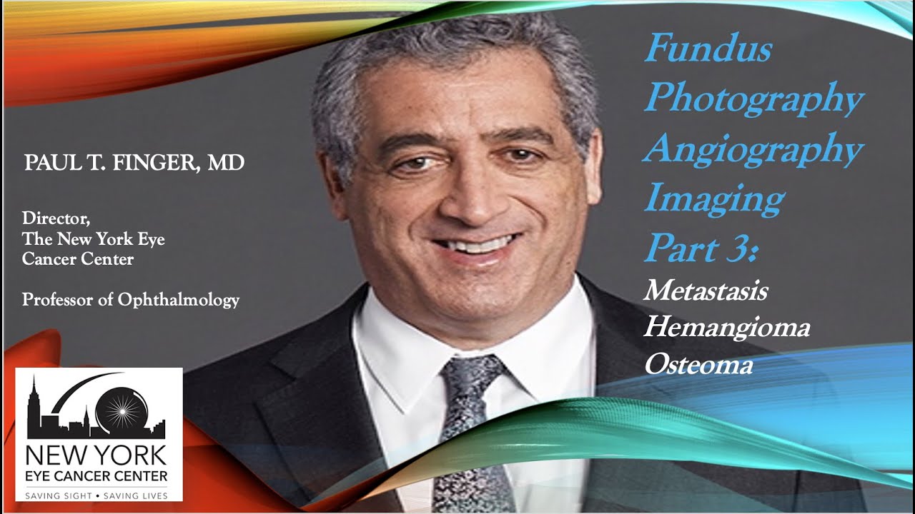 Ophthalmic Photography and Angiography Part 3: Choroidal Metastasis, Hemangioma and Osteoma