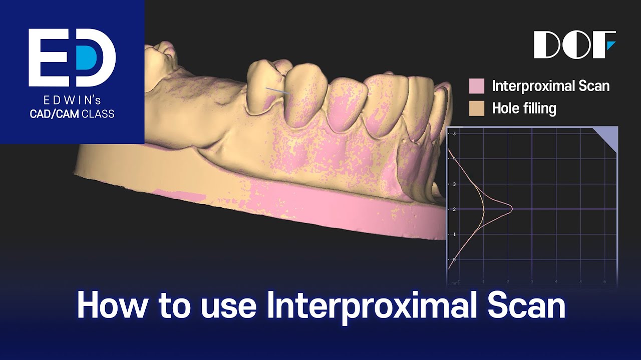 How to use Interproximal Scan