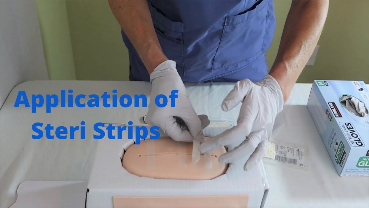 Как наносить стерильные полоски Steri-Strips | Уход за послеоперационными ранами и техника их зак...
