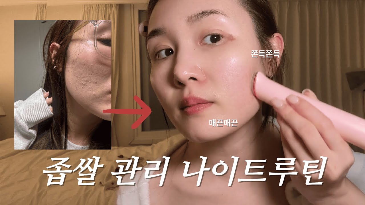 광고❌ 2년묵은 좁쌀 여드름 & 염증 없애면서 한 나이트 스킨케어, 기초템 공개 | 스킨케어 꿀팁 대공개